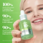 anua-us-ampoule-serum-azelaic-acid-10-hyaluron-redness-soothing-serum-1239362105 (1)